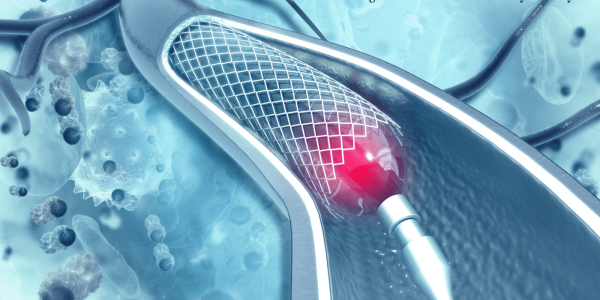 Sirolimus-Eluting Stent
